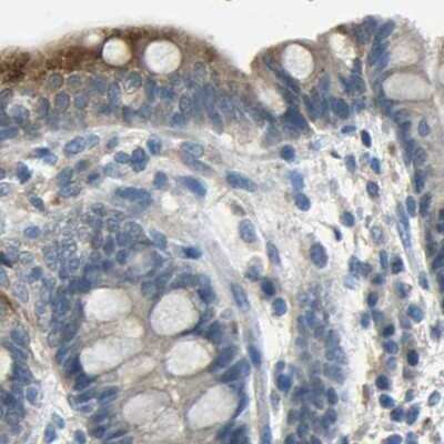 Immunohistochemistry-Paraffin: Genethonin 1 Antibody [NBP1-91935]