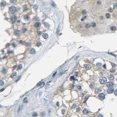 Immunohistochemistry-Paraffin: Genethonin 1 Antibody [NBP1-91935]