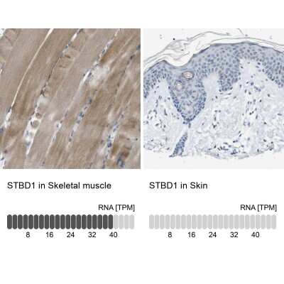 Immunohistochemistry-Paraffin: Genethonin 1 Antibody [NBP1-91936]