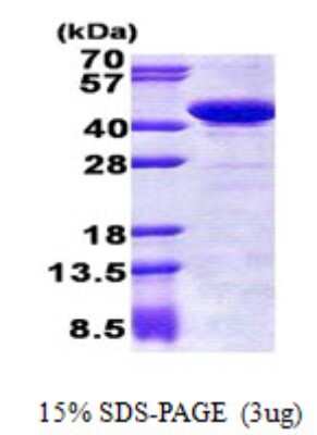 SDS-PAGE: Recombinant Human Genethonin 1 His Protein [NBP2-22828]