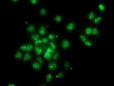 Immunocytochemistry/ Immunofluorescence: Gephyrin/GPHN Antibody (OTI3B6) [NBP2-03449]