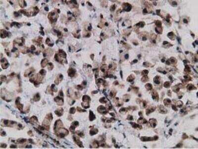 Immunohistochemistry-Paraffin: Gephyrin/GPHN Antibody (OTI3B6) [NBP2-03449]