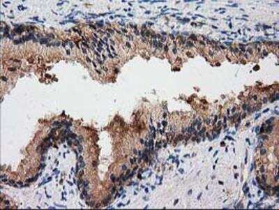 Immunohistochemistry-Paraffin: Gephyrin/GPHN Antibody (OTI3B6) [NBP2-03449]