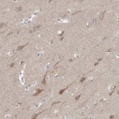 Immunohistochemistry-Paraffin: Gephyrin/GPHN Antibody [NBP1-87876]