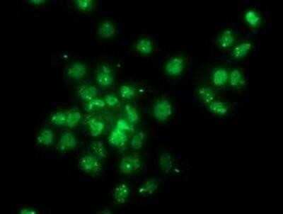 Immunocytochemistry/ Immunofluorescence: Gephyrin/GPHN Antibody (OTI3B6) - Azide and BSA Free [NBP2-71556]