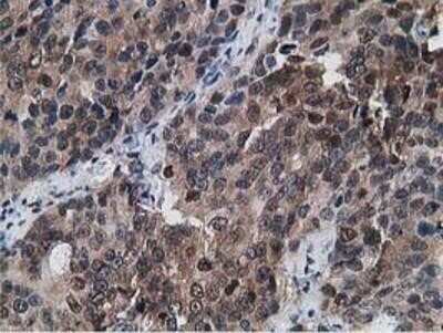 Immunohistochemistry: Gephyrin/GPHN Antibody (OTI3B6) - Azide and BSA Free [NBP2-71556]