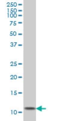 Western Blot: Ghrelin/Obestatin Antibody (2F4) [H00051738-M01]
