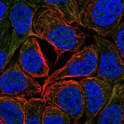 Immunocytochemistry/ Immunofluorescence: Gigaxonin Antibody [NBP2-33569]