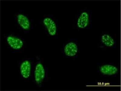 Immunocytochemistry/ Immunofluorescence: GilZ Antibody (3A5) [H00001831-M01]