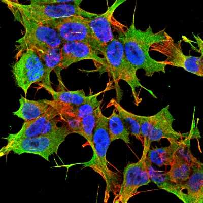 Immunocytochemistry/ Immunofluorescence: GluR1 Antibody (S355-1) [NBP2-22399]
