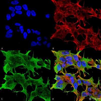Immunocytochemistry/ Immunofluorescence: GluR1 Antibody (S355-1) [NBP2-22399]
