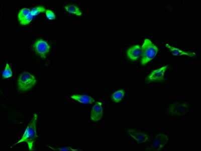 Immunocytochemistry/ Immunofluorescence: GluR2/3 Antibody (4C3) [NBP3-15223]
