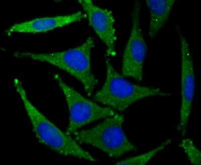 Immunocytochemistry/ Immunofluorescence: GluR2 Antibody (JU20-43) [NBP2-75510]
