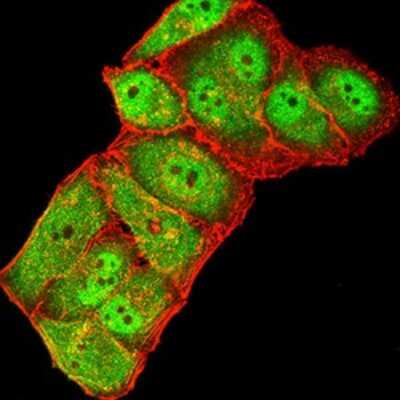 Immunocytochemistry/ Immunofluorescence: GluR7/GRIK3 Antibody (2B3D1) - BSA Free [NBP2-61782]