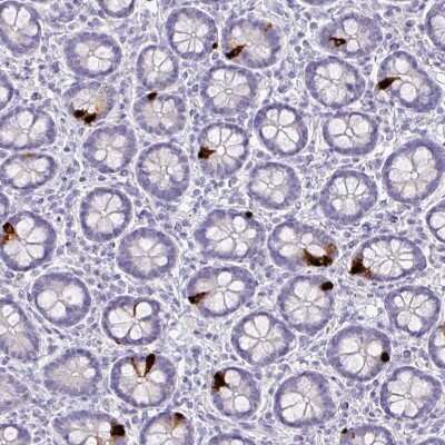 Immunohistochemistry-Paraffin: Glucagon Antibody [NBP2-38330]