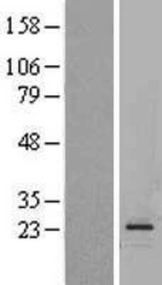 Western Blot: Glucagon Overexpression Lysate [NBL1-11005]