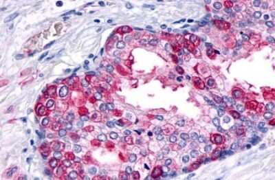 Immunohistochemistry-Paraffin: Glucagon R/GCGR Antibody - BSA Free [NLS4257]