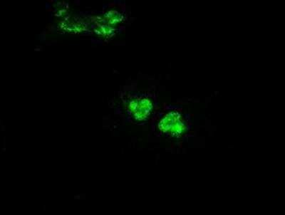 Immunocytochemistry/ Immunofluorescence: Glucokinase/GCK Antibody (OTI3E3) [NBP1-47778]