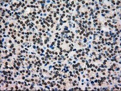 Immunohistochemistry-Paraffin: Glucokinase/GCK Antibody (OTI3E3) [NBP1-47778]