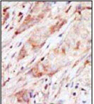 Immunohistochemistry-Paraffin: Glucokinase/GCK Antibody [NBP1-50694]