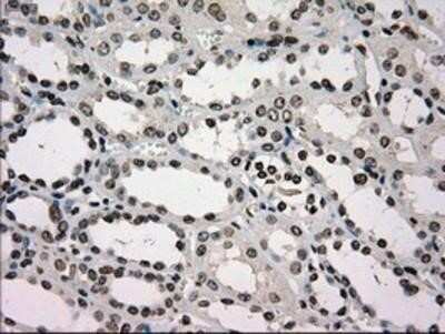 Immunohistochemistry: Glucokinase/GCK Antibody (OTI3E3) - Azide and BSA Free [NBP2-70822]
