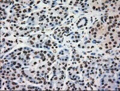 Immunohistochemistry: Glucokinase/GCK Antibody (OTI3E3) - Azide and BSA Free [NBP2-70822]