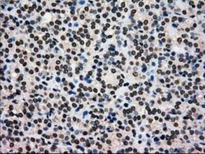 Immunohistochemistry: Glucokinase/GCK Antibody (OTI3E3) - Azide and BSA Free [NBP2-70822]