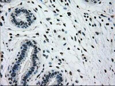 Immunohistochemistry: Glucokinase/GCK Antibody (OTI3E3) - Azide and BSA Free [NBP2-70822]