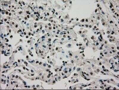 Immunohistochemistry: Glucokinase/GCK Antibody (OTI3E3) - Azide and BSA Free [NBP2-70822]