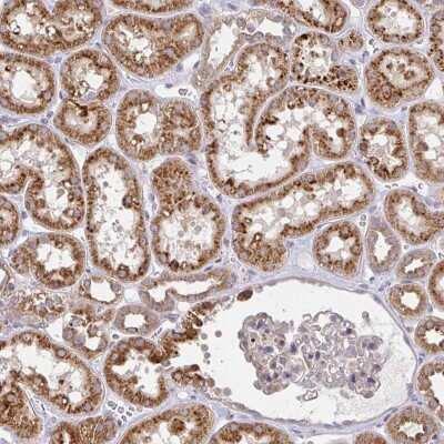 Immunohistochemistry: Glucosamine (N-acetyl)-6-Sulfatase/GNS Antibody [NBP2-38583]