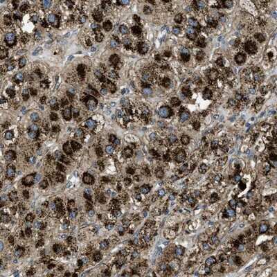 Immunohistochemistry-Paraffin: Glucosamine (N-acetyl)-6-Sulfatase/GNS Antibody [NBP1-86084]