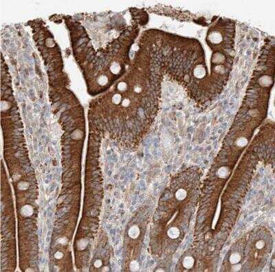 Immunohistochemistry-Paraffin: Glucosaminyl (N-acetyl) Transferase 1/GCNT1 Antibody [NBP1-86809]