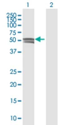 Western Blot: Glucosaminyl (N-acetyl) Transferase 1/GCNT1 Antibody [H00002650-B01P]