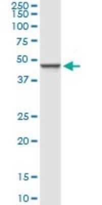 Western Blot: Glucosaminyl (N-acetyl) Transferase 1/GCNT1 Antibody [H00002650-D01P]