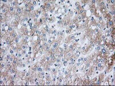 Immunohistochemistry-Paraffin: Glucose 1-dehydrogenase Antibody (OTI2A7) [NBP2-02615]