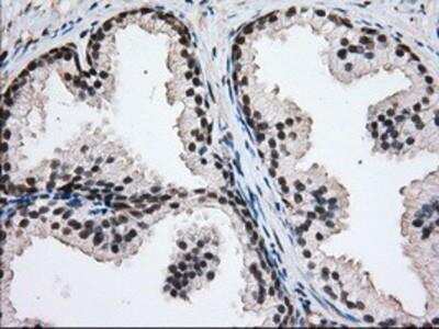 Immunohistochemistry-Paraffin: Glucose 1-dehydrogenase Antibody (OTI2A7) [NBP2-02615]