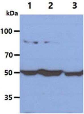 Western Blot: Glucose 6 Phosphate Dehydrogenase Antibody (2F6)BSA Free [NBP1-30358]