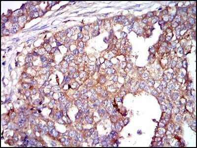Immunohistochemistry-Paraffin: Glucose 6 Phosphate Dehydrogenase Antibody (2H7) - Azide and BSA Free [NBP2-80752]