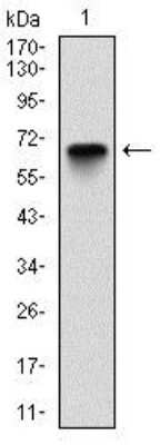 Western Blot: Glucose 6 Phosphate Dehydrogenase Antibody (2H7)BSA Free [NBP2-22125]