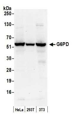 Western Blot: Glucose 6 Phosphate Dehydrogenase Antibody [NB100-236]