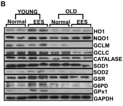 Western Blot: Glucose 6 Phosphate Dehydrogenase Antibody [NB100-236]