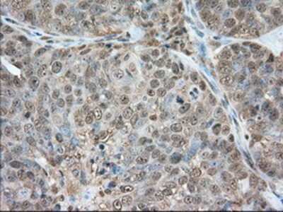 Immunohistochemistry-Paraffin: Glucose 6 phosphate isomerase Antibody (OTI2D2) [NBP2-02541]