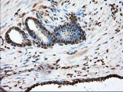 Immunohistochemistry-Paraffin: Glucose 6 phosphate isomerase Antibody (OTI2D2) [NBP2-02541]