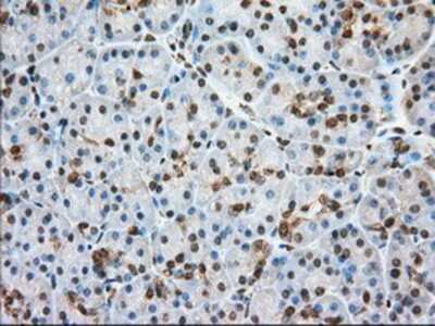 Immunohistochemistry-Paraffin: Glucose 6 phosphate isomerase Antibody (OTI2D2) [NBP2-02541]