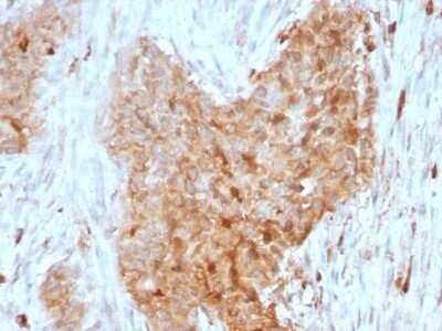 Immunohistochemistry-Paraffin: Glucose 6 phosphate isomerase Antibody (CPTC-GPI-1) - Azide and BSA Free [NBP2-79845]
