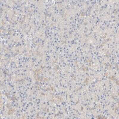 Immunohistochemistry-Paraffin: Glucose 6 phosphate isomerase Antibody [NBP1-90177]