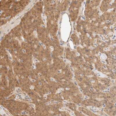 Immunohistochemistry-Paraffin: Glucose 6 phosphate isomerase Antibody [NBP1-90177]