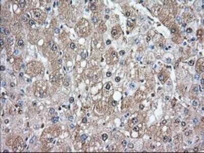 Immunohistochemistry: Glucose 6 phosphate isomerase Antibody (OTI2D2) - Azide and BSA Free [NBP2-70844]