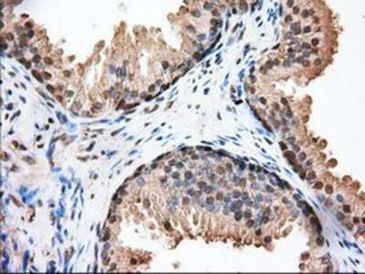 Immunohistochemistry: Glucose 6 phosphate isomerase Antibody (OTI2D2) - Azide and BSA Free [NBP2-70844]