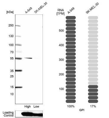 Western Blot: Glucose 6 phosphate isomerase Antibody [NBP2-58524]